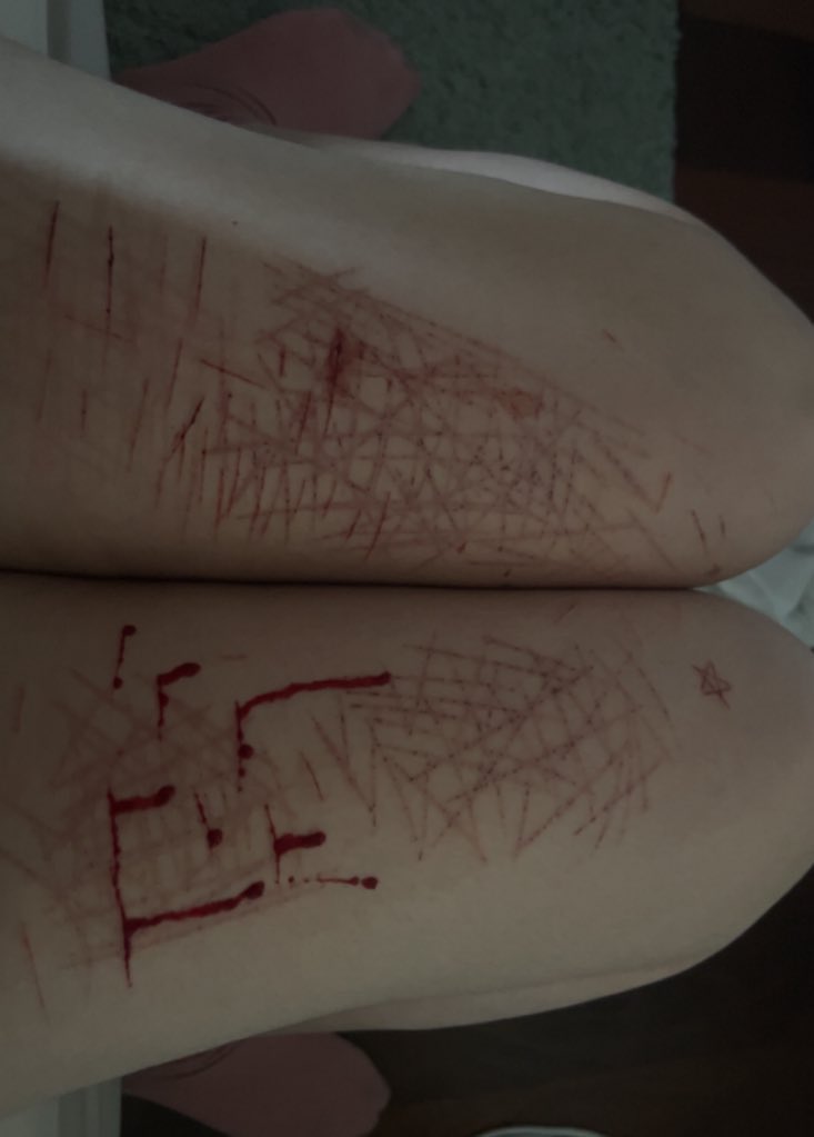 Thalasaphobia tweet media