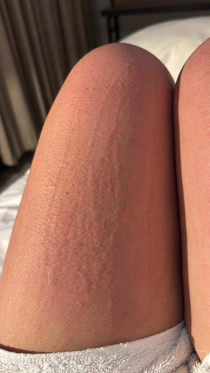 sachysach tweet media