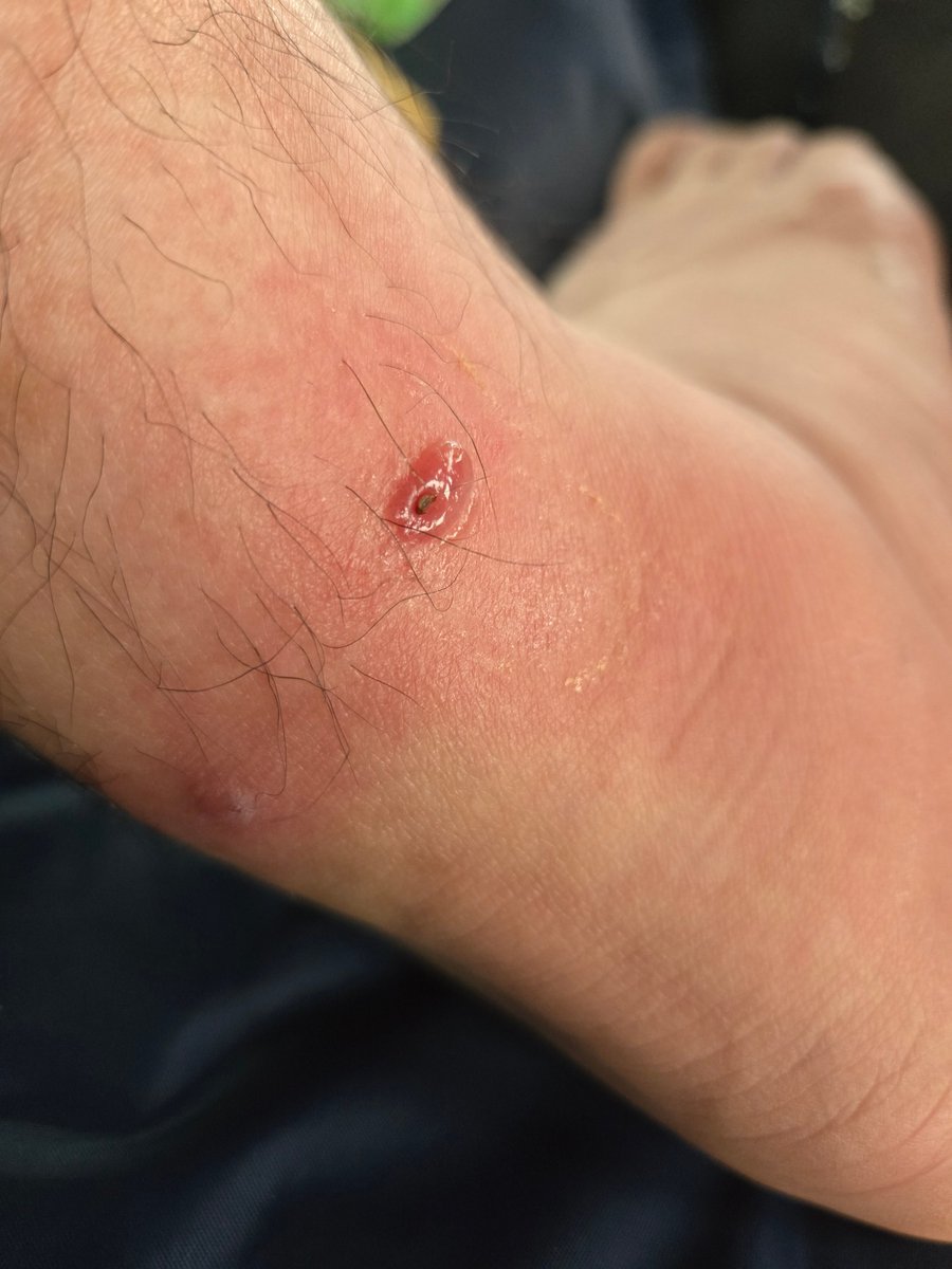 バトルヒーター(鉄道垢) tweet media