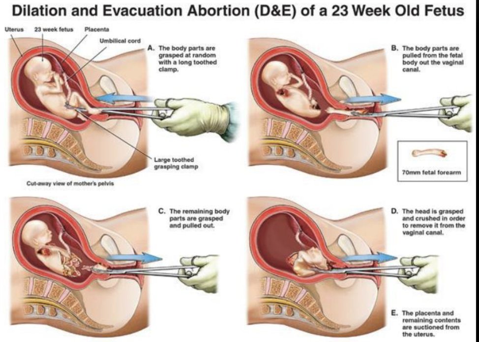 Students for Life of America | Pro-Life Gen tweet media