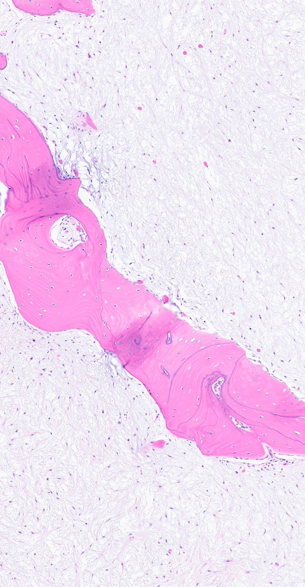 ZemplenPataki's tweet photo. Time to myx things up:
Mandible. What is your diagnosis? 🔎

Poll below 🗳️👇

#PathPuzzle 🕵️‍♂️
@UMichPath #Pathology #PathX #PathTwitter https://t.co/OUr8rAohii