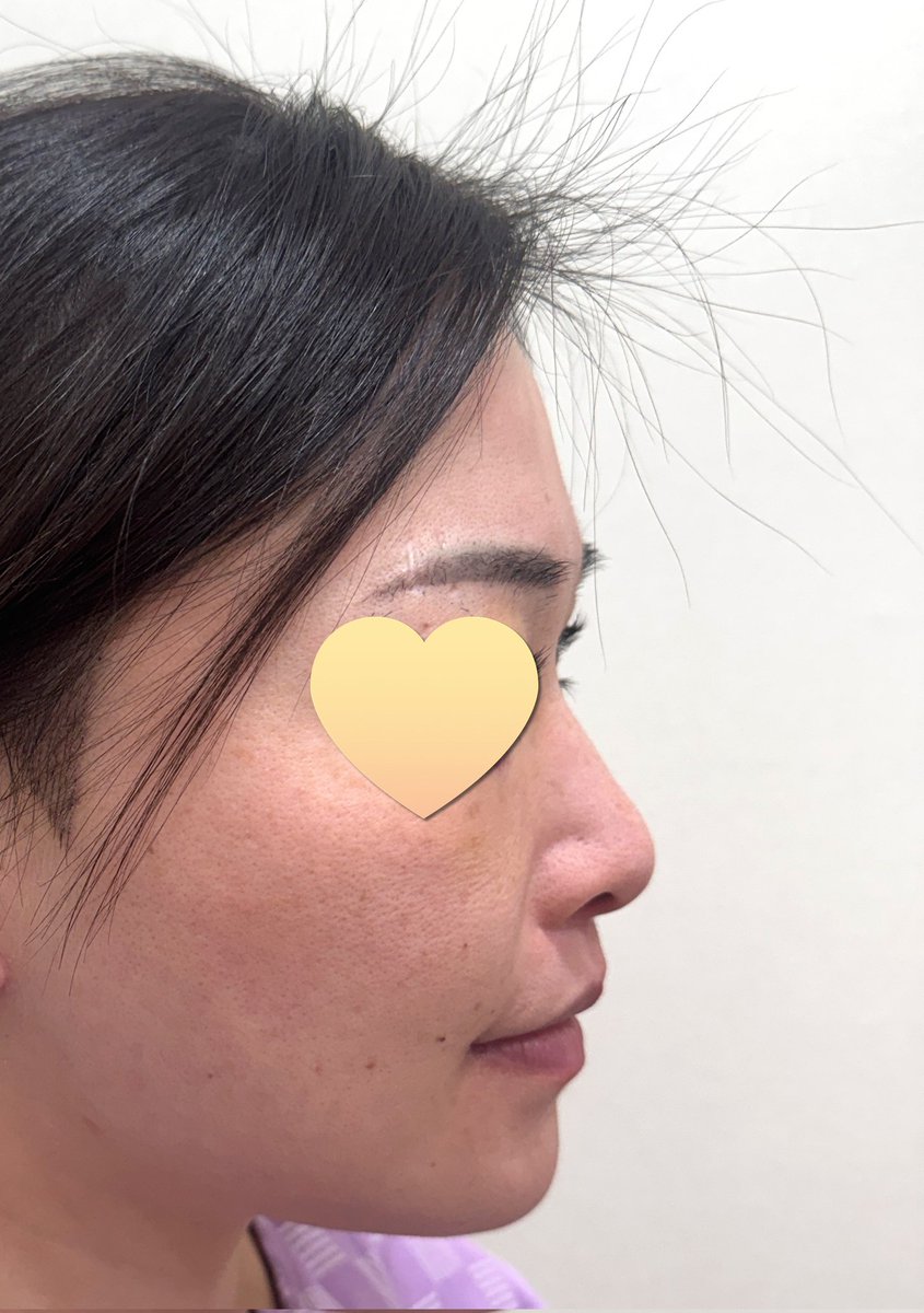 せぶちゃ@整形アカ tweet media