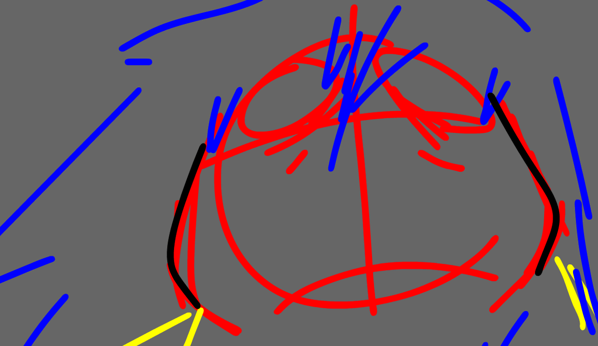 =Vanillanomas= tweet media