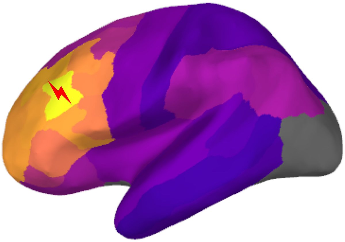 Brain tweet media