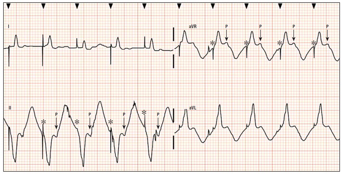 12 Derivaciones ECG tweet media