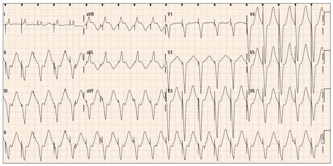 12 Derivaciones ECG tweet media