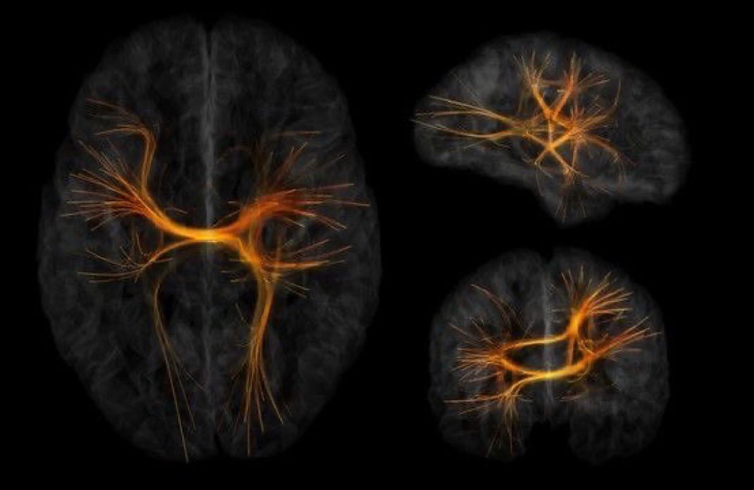 ZA tweet media