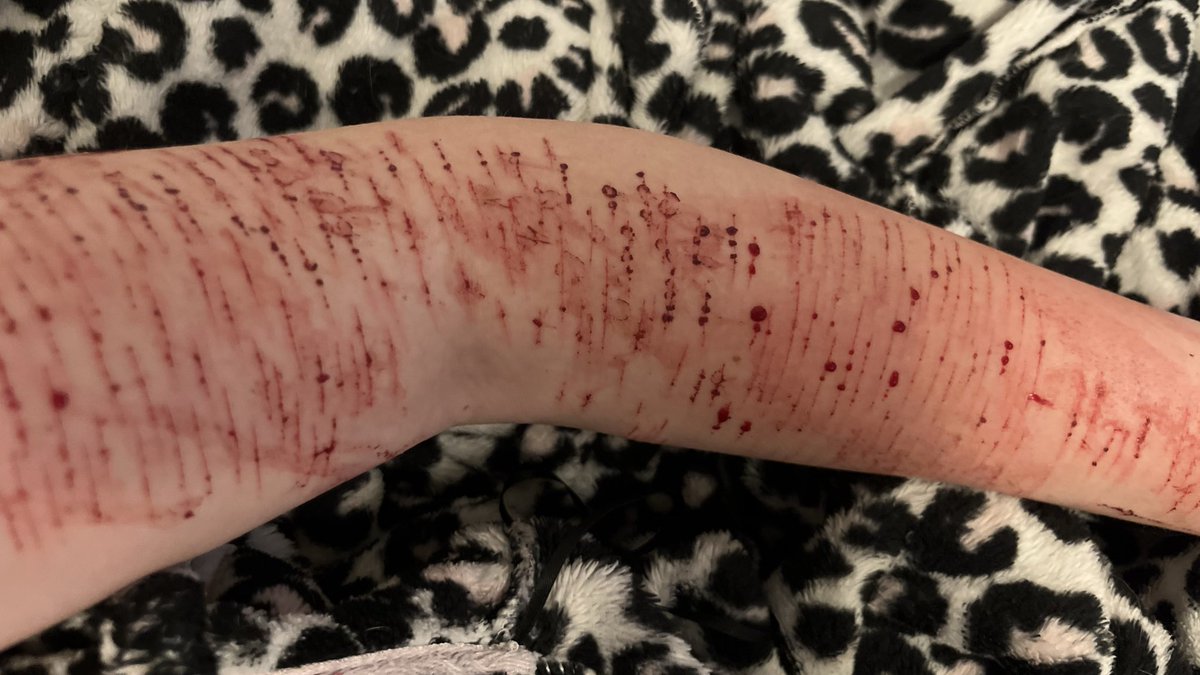 Angie || shedtwt || 𐔌՞. .՞𐦯 tweet media