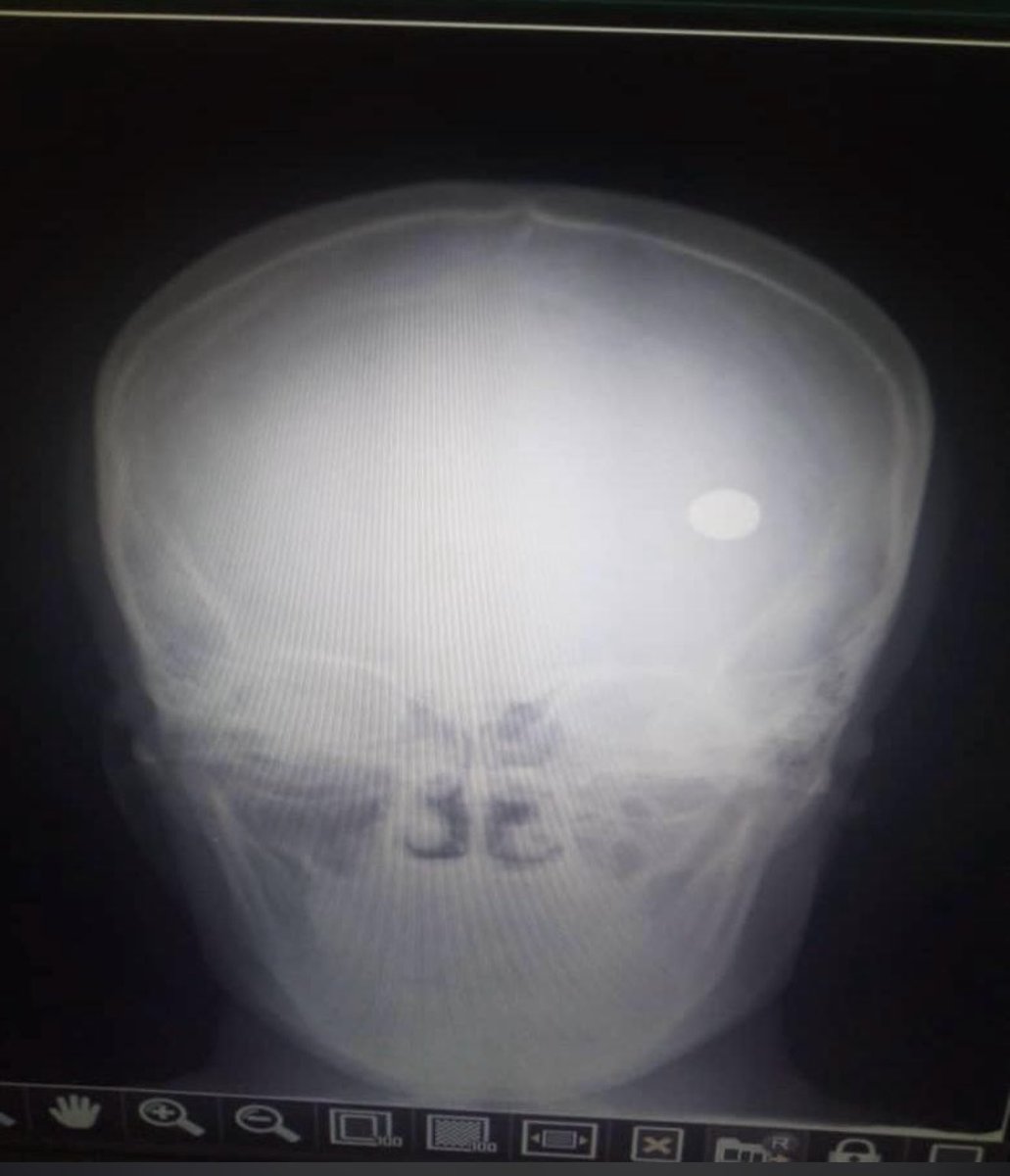 Ameh Itodo MD tweet media