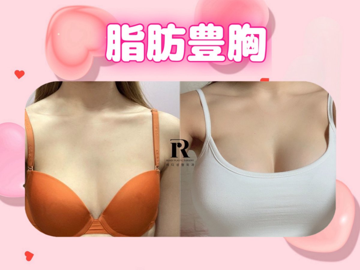 READY PLASTIC SURGERY🎀(#脂肪吸引 #移植専門)整形外科専門医 tweet media