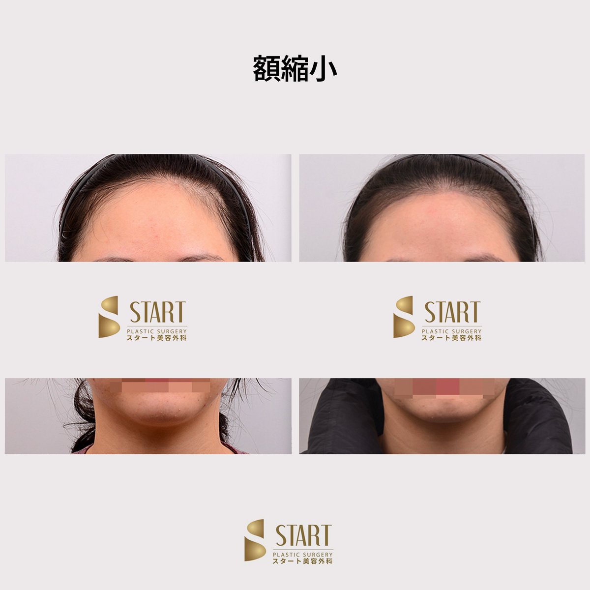 スタート整形外科 tweet media