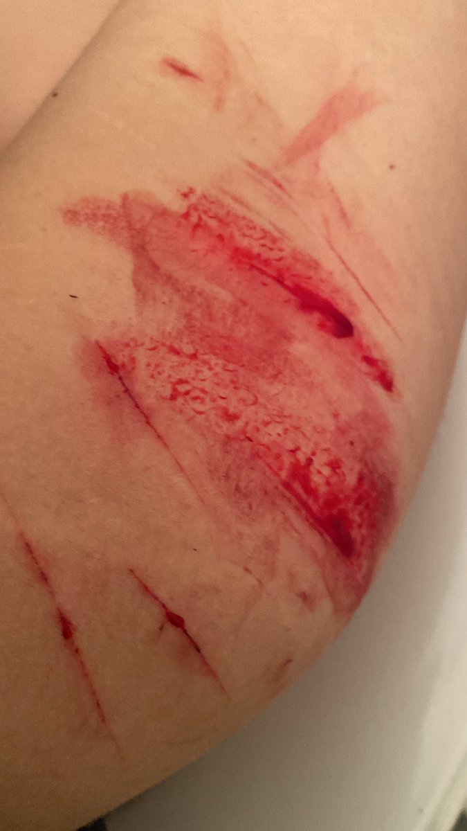 LttleSlvt4ddy tweet media