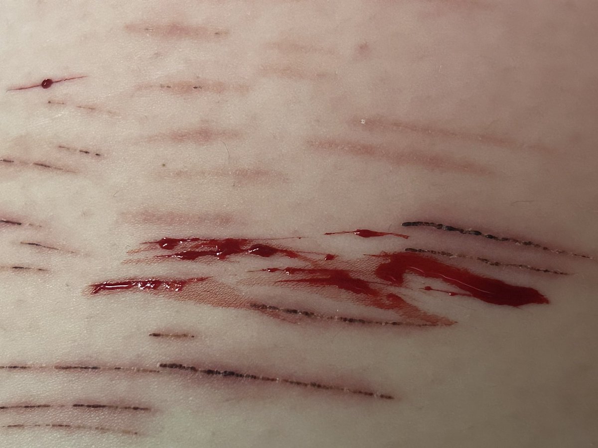 junkrat of shtwt ˚ʚ♡ɞ˚ tweet media