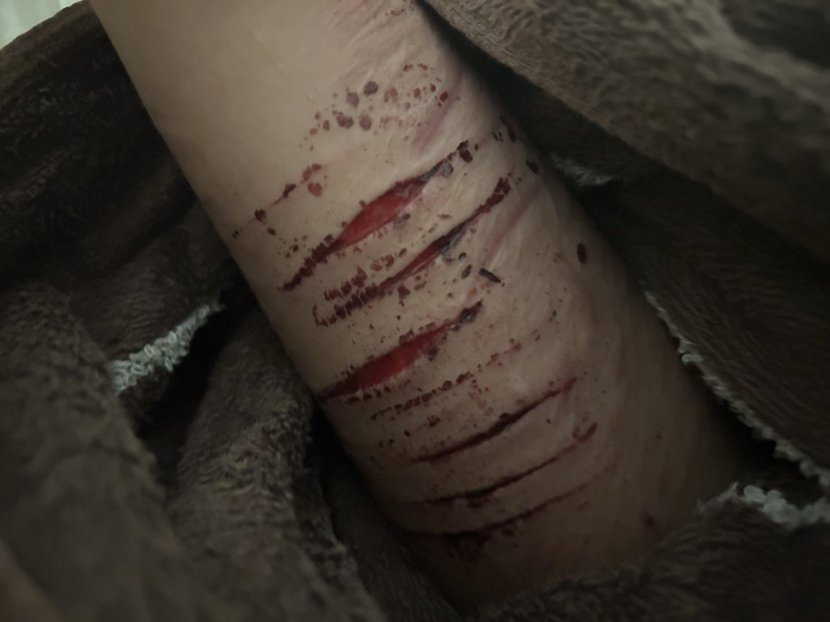 Morphine shtwt/edtwt/obstwt tweet media