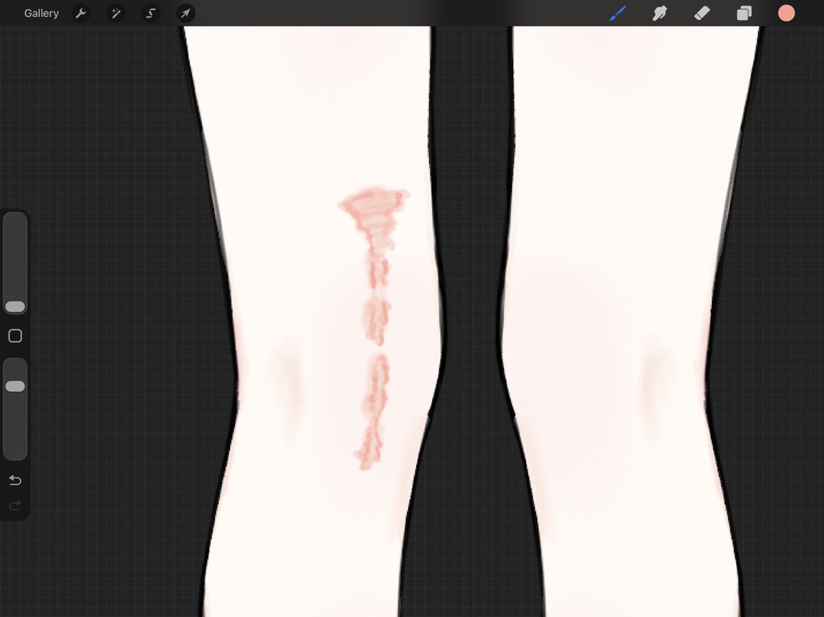 CakeBluebe73402's tweet photo. Knee surgery for my oc because I refuse to give her an easy life 🫡

#OC #WIP #VTuberDesign #ArtistOnX #AnimeArt https://t.co/mF8t9PFO0H