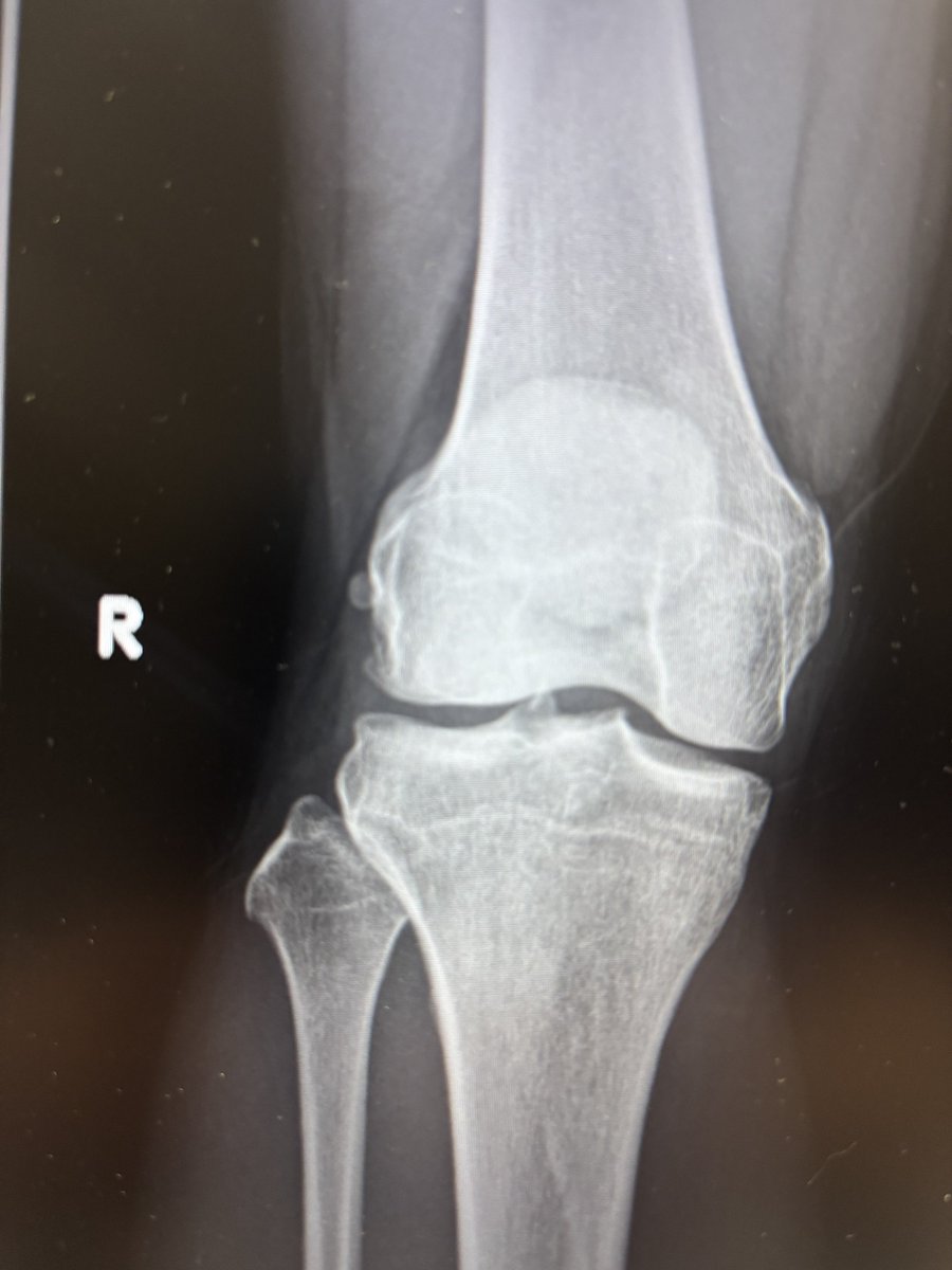 Zing=Nicks tweet media