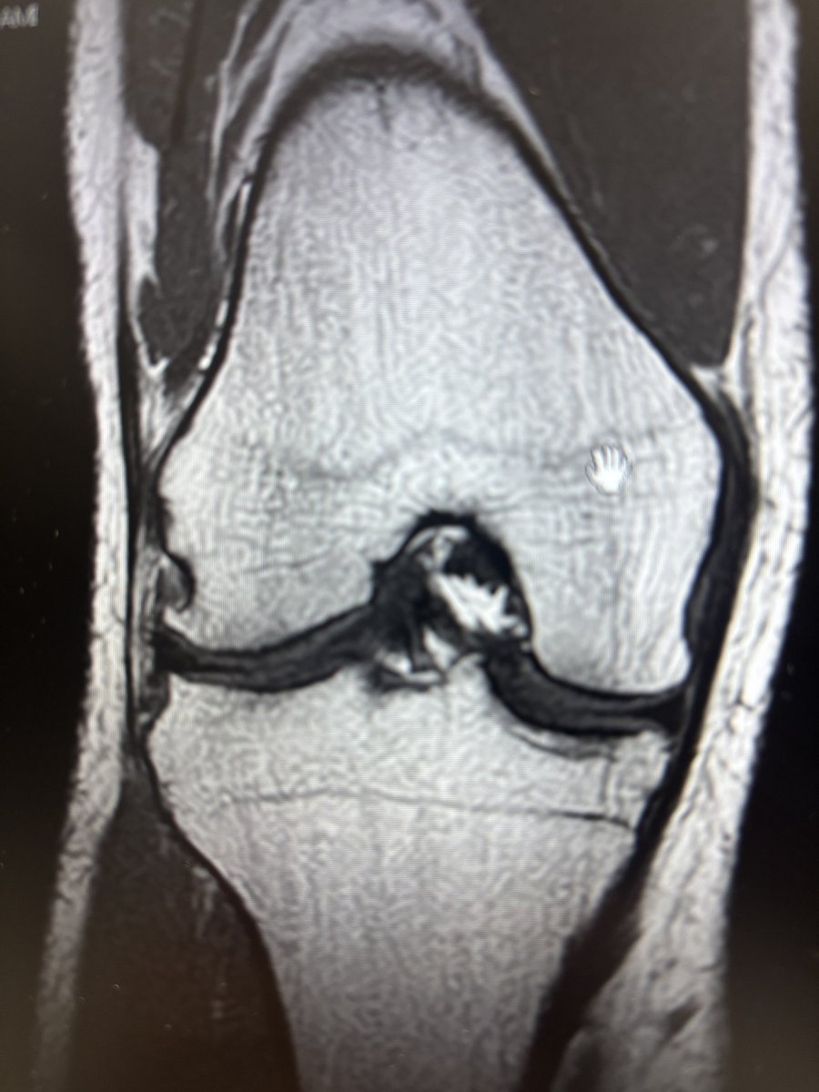 Zing=Nicks tweet media