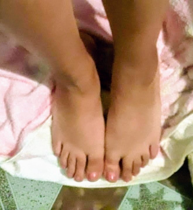 Toes r Us tweet media