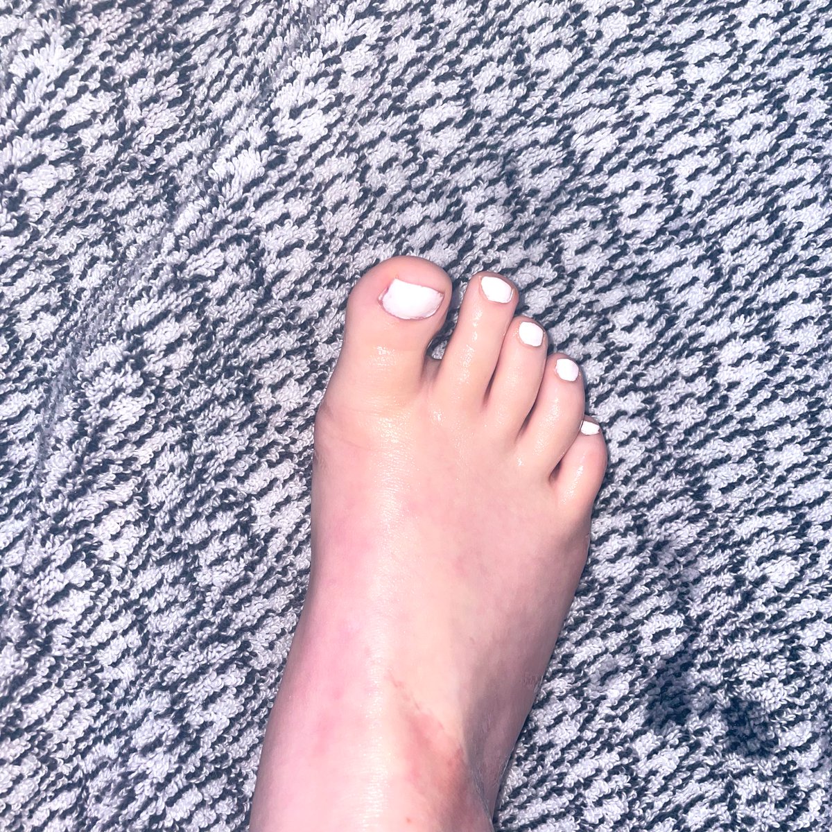 cute toes;) tweet media