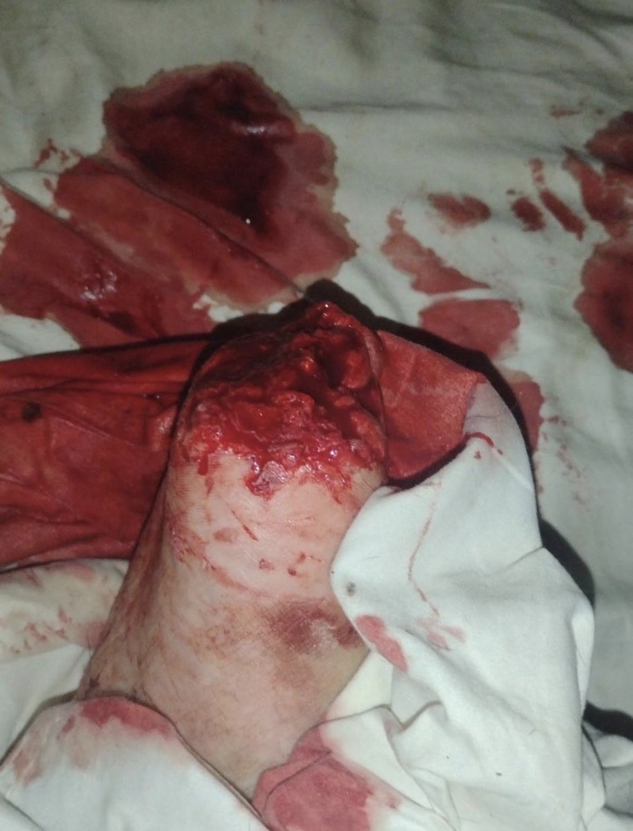 Белла🫗shtwt goretwt (@cuttobeans) on Twitter photo 