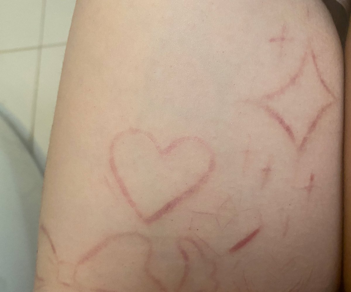 ᧔•᧓ tweet media