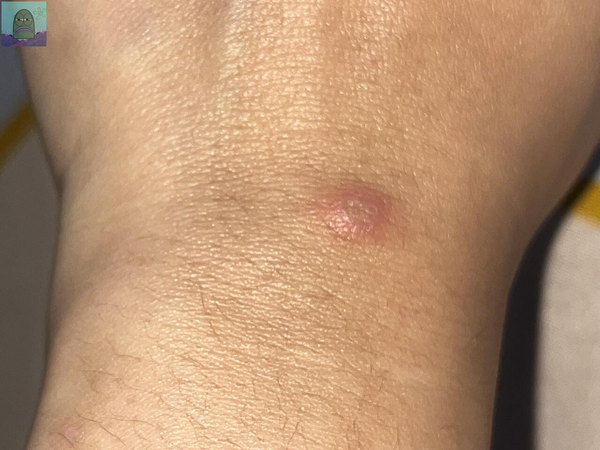 Tanyarl 💚 tweet media