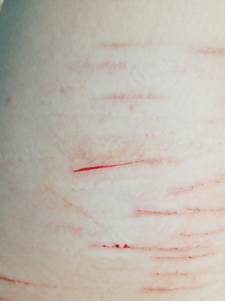 Ticci Toby of shedtwt tweet media