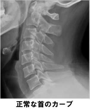 いとう、 tweet media