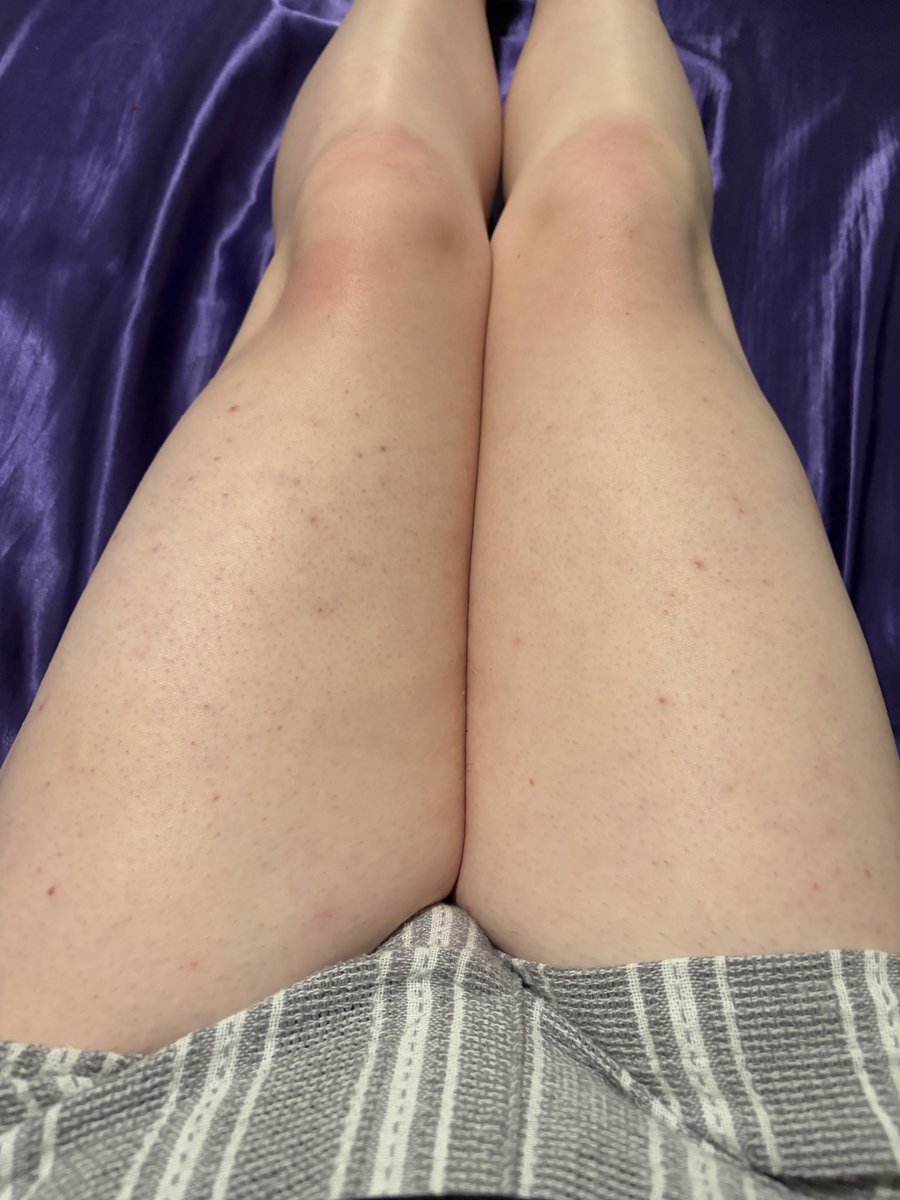 🌟Kai🌟 tweet media