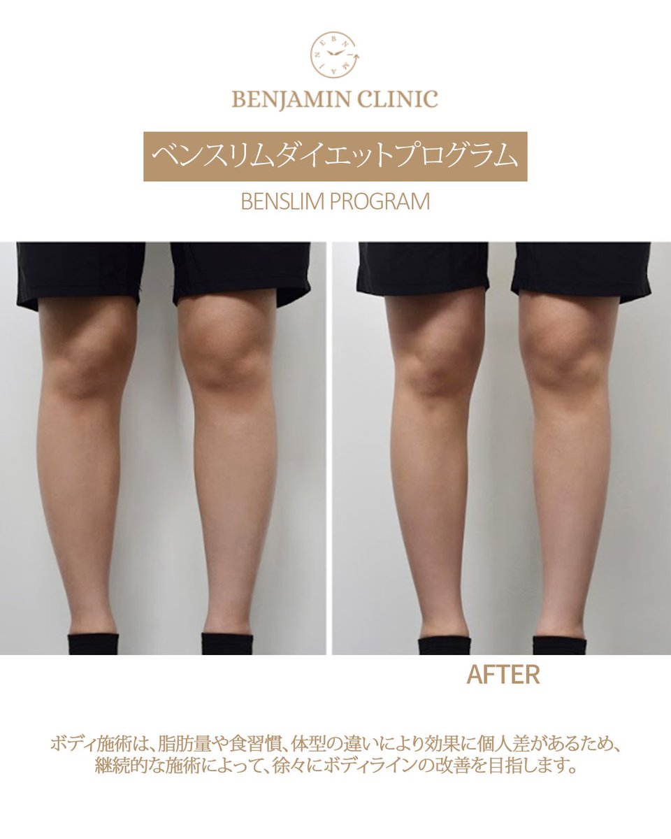 【韓国美容】ベンジャミンクリニック tweet media