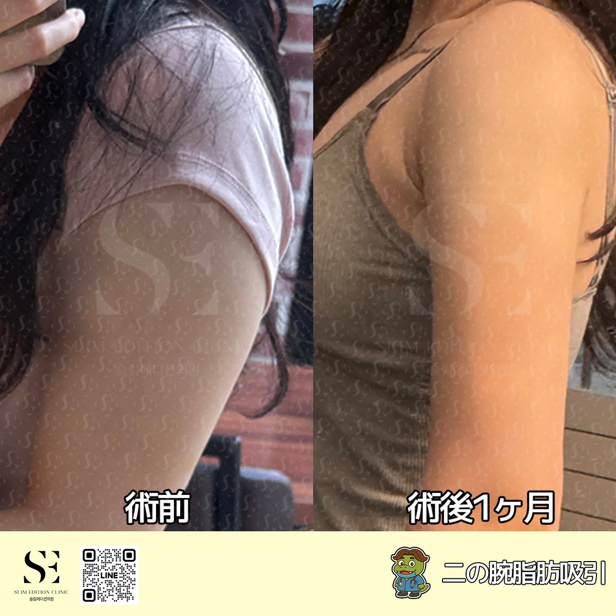 スリムエディション医院 tweet media