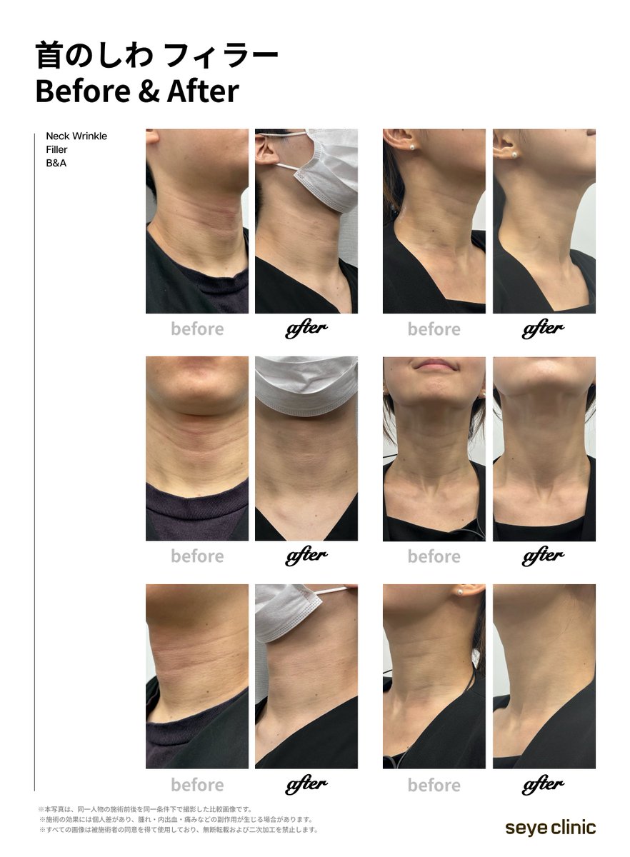 【公式】セイェクリニック 韓国美容 tweet media