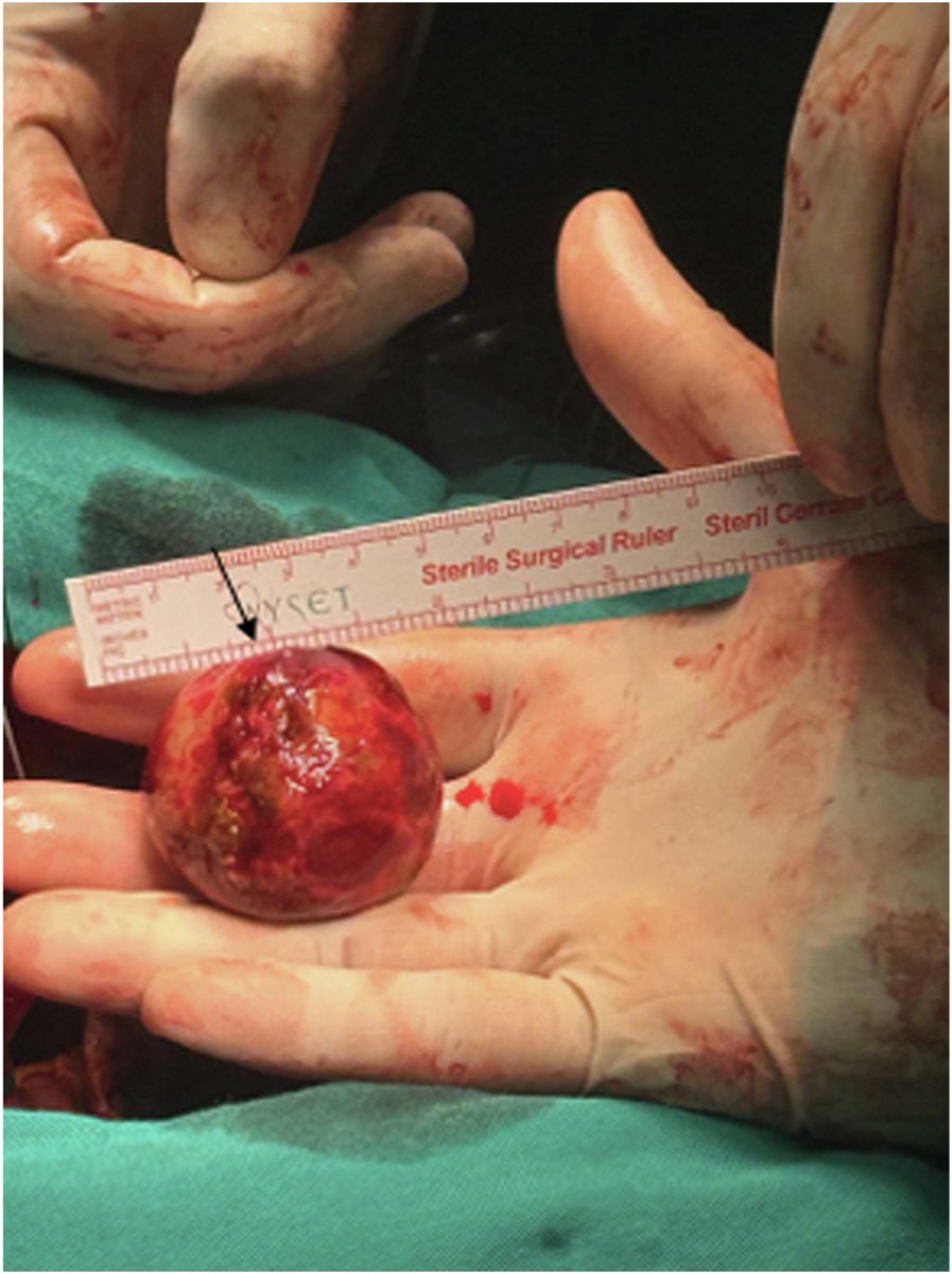 V.L.Sorrell, MD (@CASEfromASE EIC) tweet media