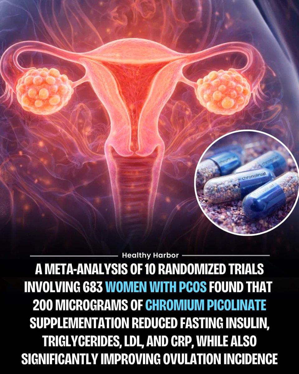 argosaki's tweet image. 🌟 2026 PCOS Game-Changer? 2025 Meta-Analysis Shows Chromium Picolinate Rivals Metformin for Insulin Resistance, Ovulation &amp;amp; Hormone Balance – With Fewer Side Effects! 💊🩸 #PCOS #ChromiumPicolinate #NaturalPCOSSupport #PolycysticOvarySyndrome  A 2025 systematic review and