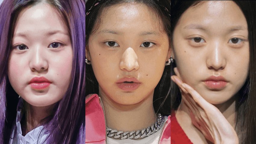 鼻整形の病院探し🏥鼻尖形成、輪郭3点、二重切開、鼻中隔延長、鼻フル、目頭切開、鼻翼縮小、小鼻縮小 tweet media