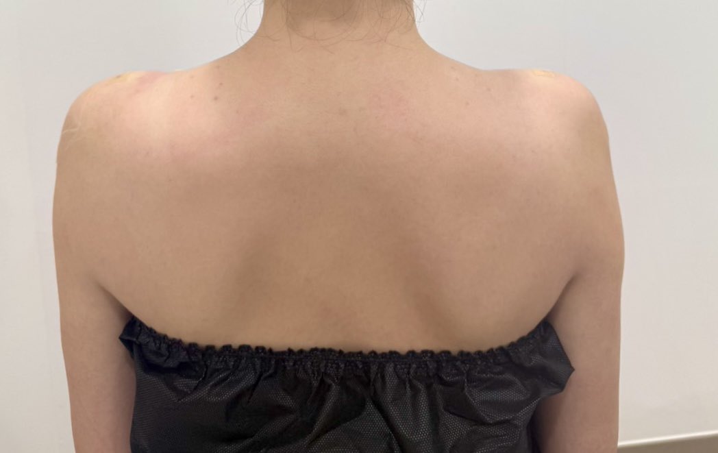 美容整形ちゃん👩YouTuber tweet media