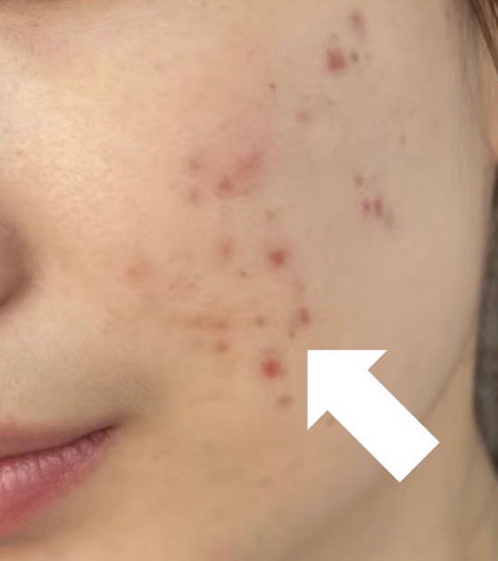 セリナ|韓国コス🇰🇷 tweet media