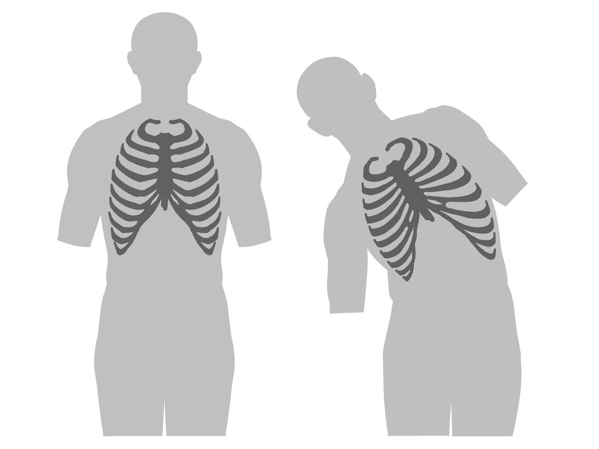 伊豆の美術解剖学者 tweet media