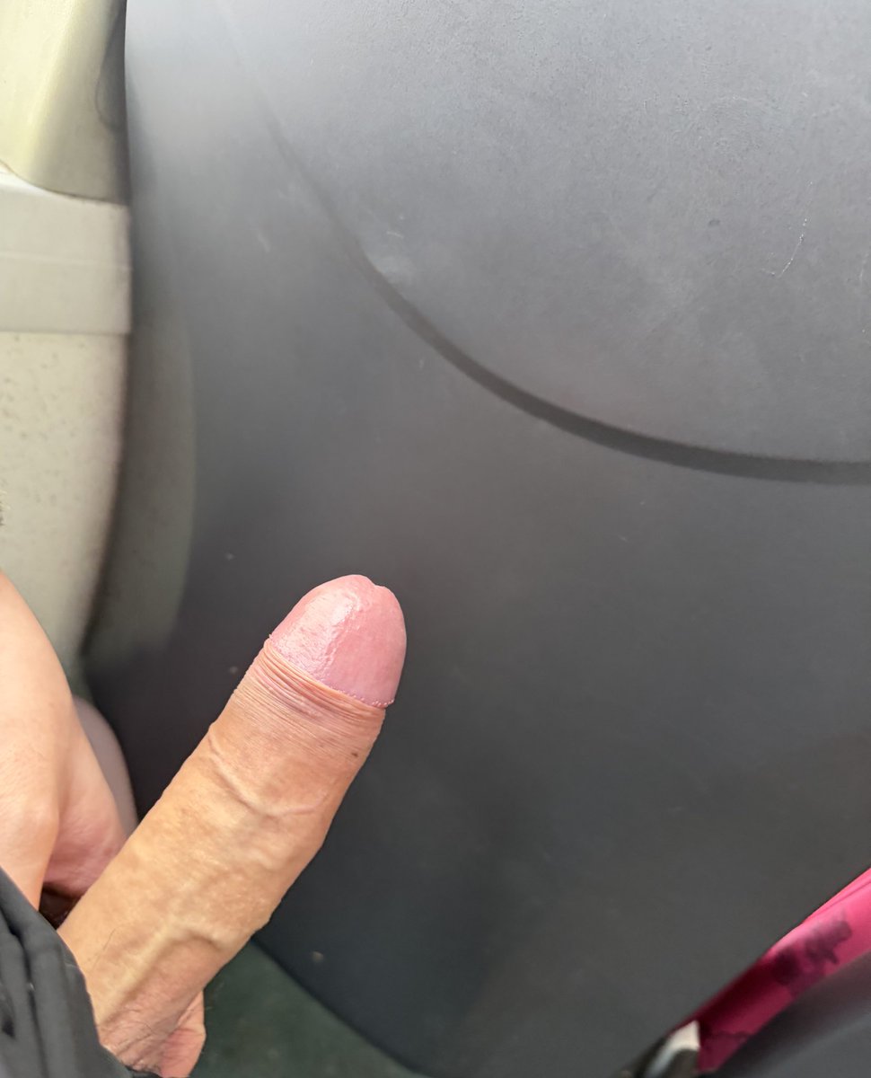 fat_fat_b's tweet photo. 手痕🤪🤪 https://t.co/3DbQhtikNI