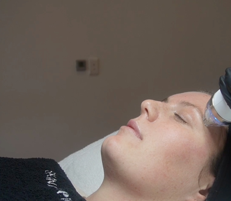 Skin Renewal SA tweet media