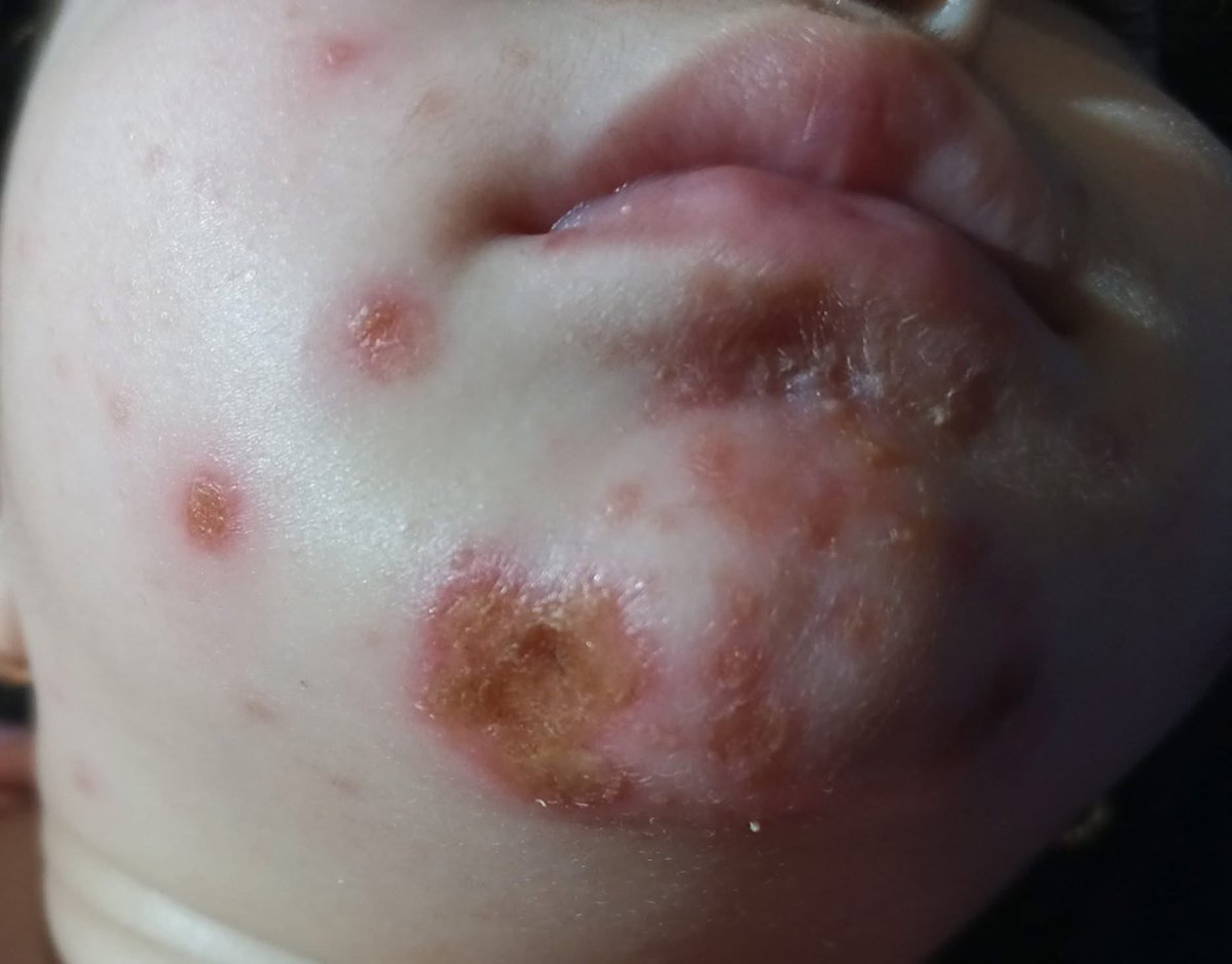 Dr.SAEB_FROM_GAZA tweet media