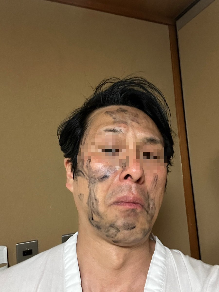 本日の使用前、使用後。。。

#いろいろごめんなさい