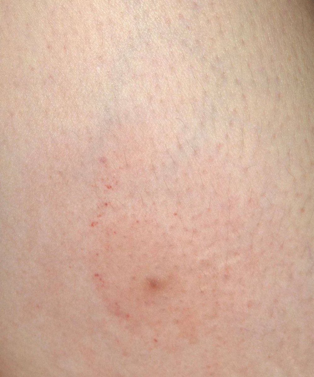 Raadish🇯🇴🇮🇳 tweet media