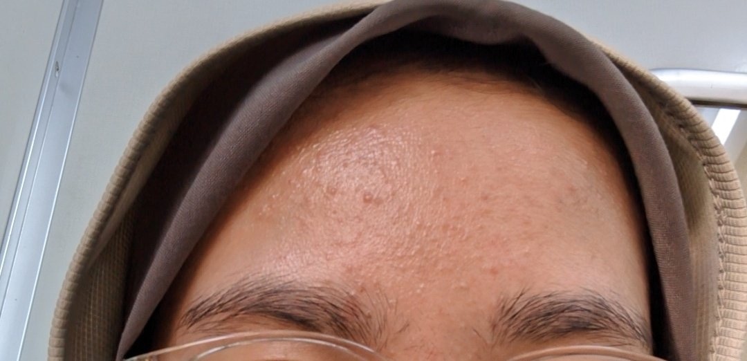 ✨OMBB | 🚫NO LINK tweet media