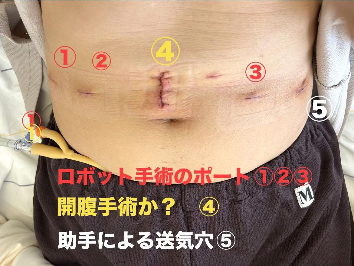 前立腺ガンを克服するぞー tweet media