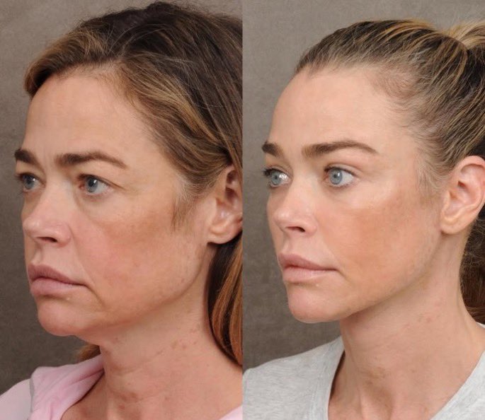 𝕰𝖒𝕲 tweet media