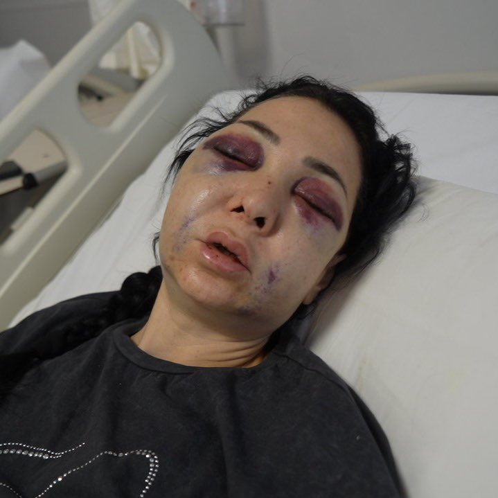 DarkWeb Haber tweet media