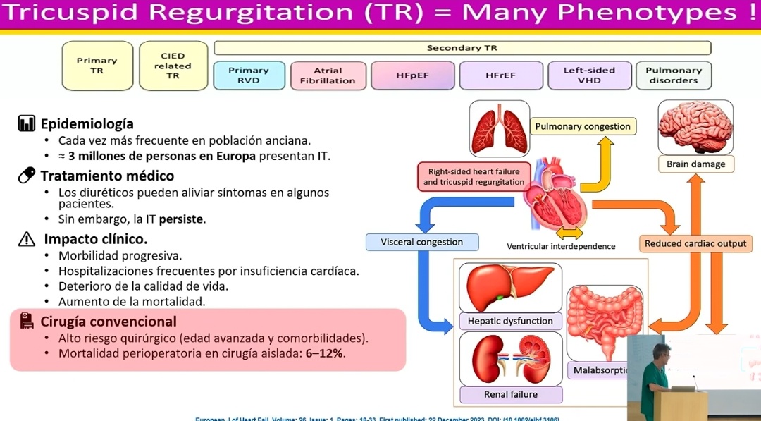 Insuficiencia Cardiaca y Trasplante tweet media
