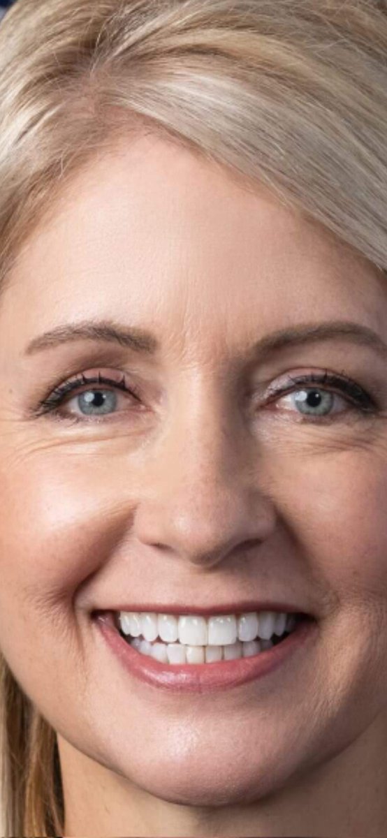 kifflom57's tweet photo. @DougWahl1 This face screams i like to poop in fruit loops. https://t.co/3tw8GpchVB