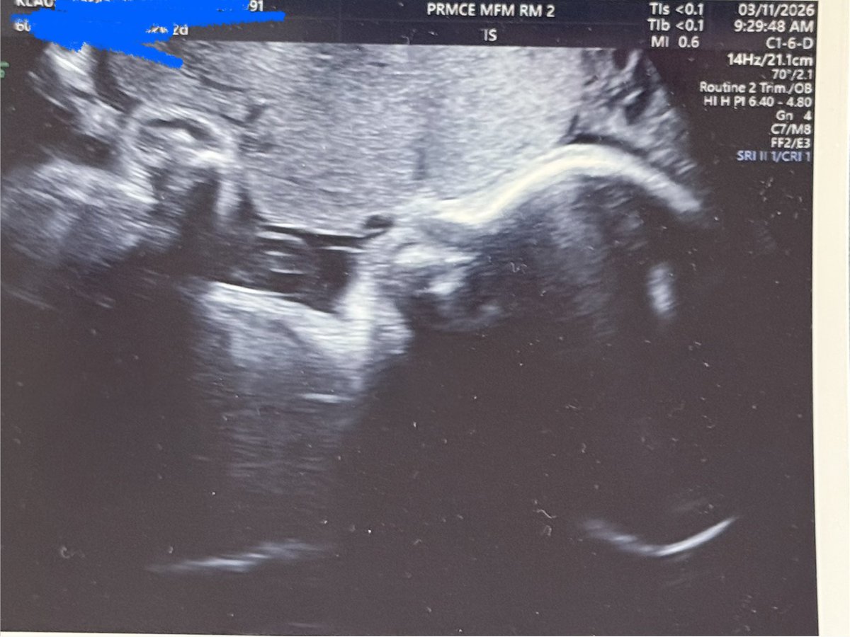 Flash 🇺🇸 tweet media